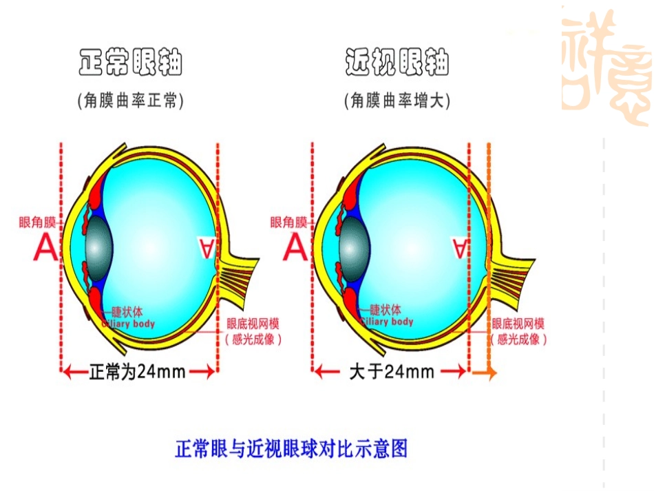 2012年西大附中学生近视眼预防_第2页