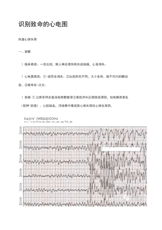 识别致命的心电图