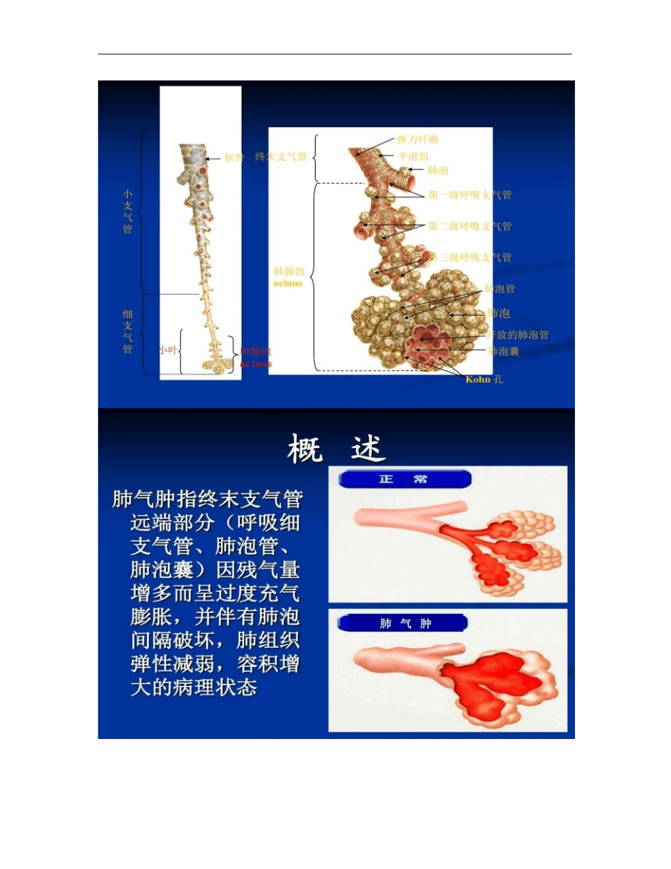 慢性阻塞性肺气肿教学讲解_第2页