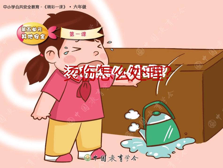 烫伤怎么处理_第1页