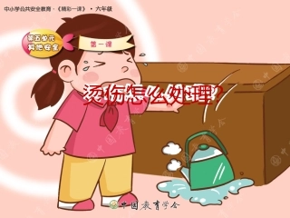 烫伤怎么处理