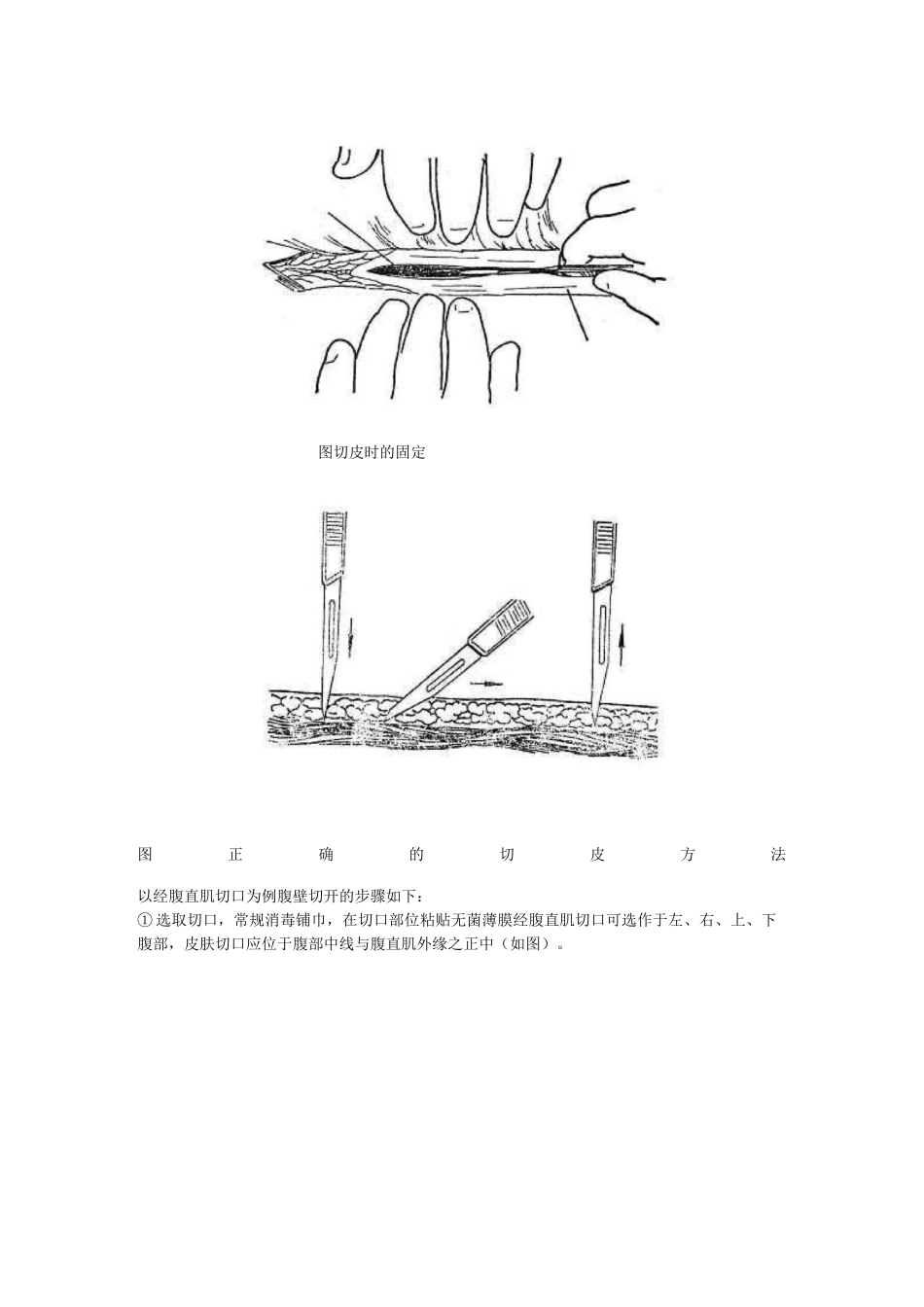 切开,各种缝合技术_第2页