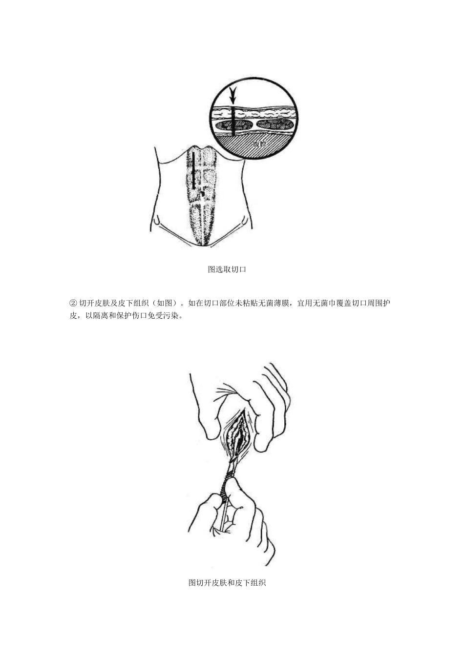 切开,各种缝合技术_第3页