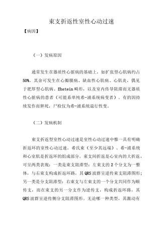 束支折返性室性心动过速