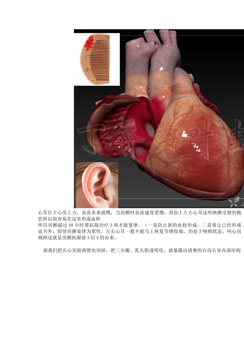 3D动画图解心脏大体解剖_第3页