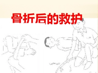 年级骨折后的救护课件