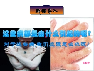 人教版必修二第5章第3节人类遗传病（共48张PPT）