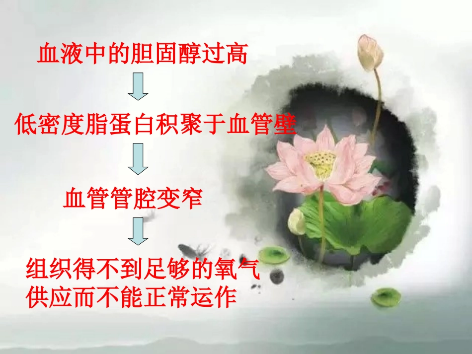 粥状动脉硬化及预防_第2页