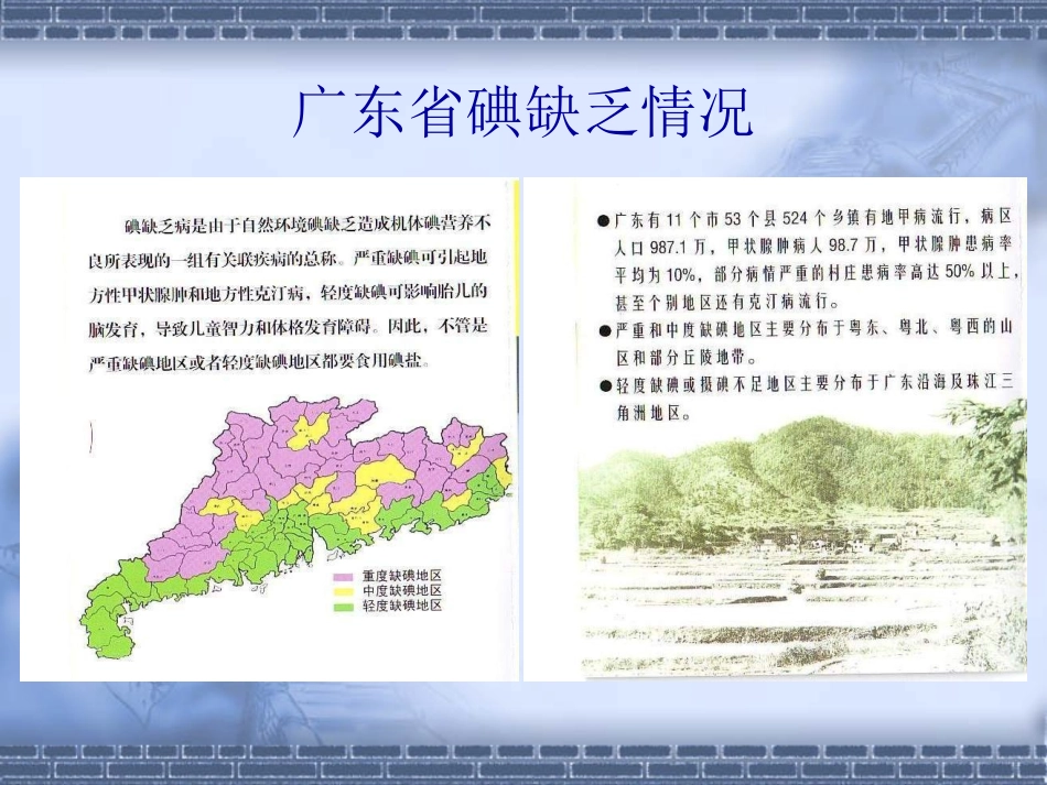 碘缺乏病防治知识课件_第2页