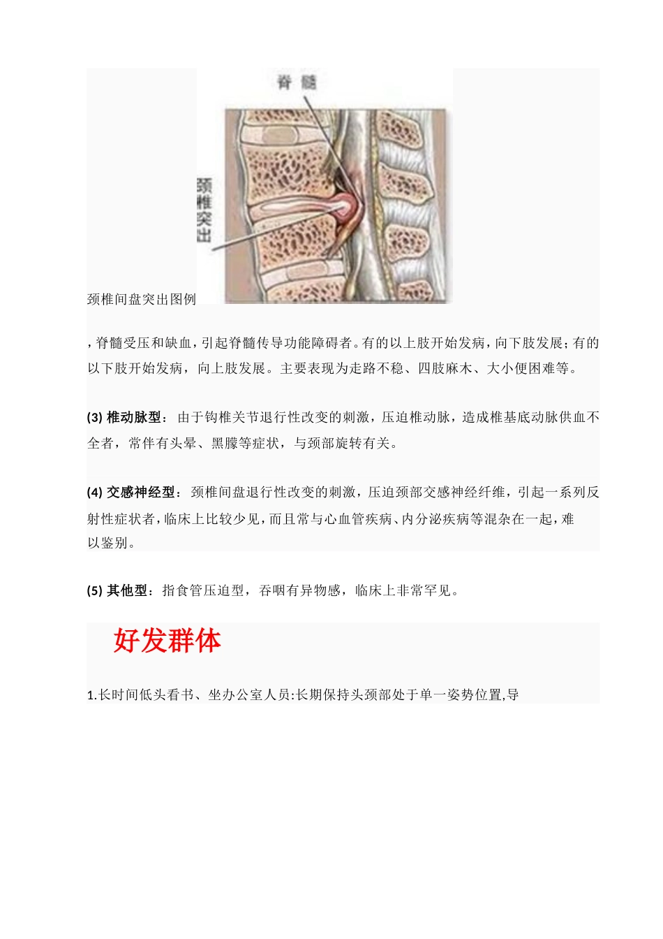 颈椎病健康宣教_第3页