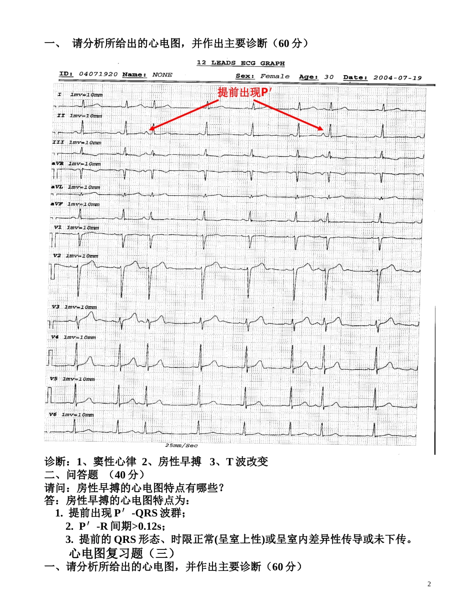临床“三基”考试心电图复习题(图及答案)-(1)_第2页