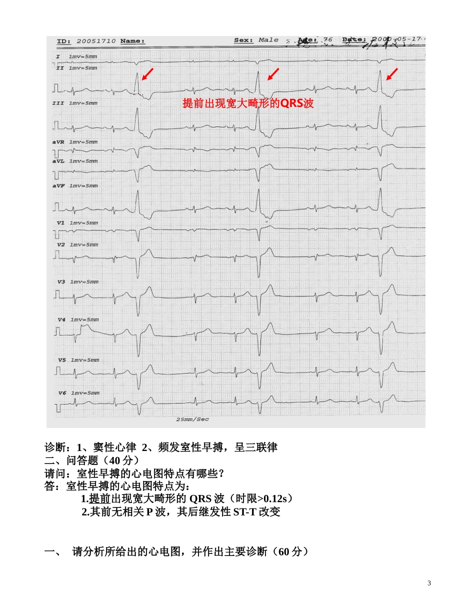 临床“三基”考试心电图复习题(图及答案)-(1)_第3页