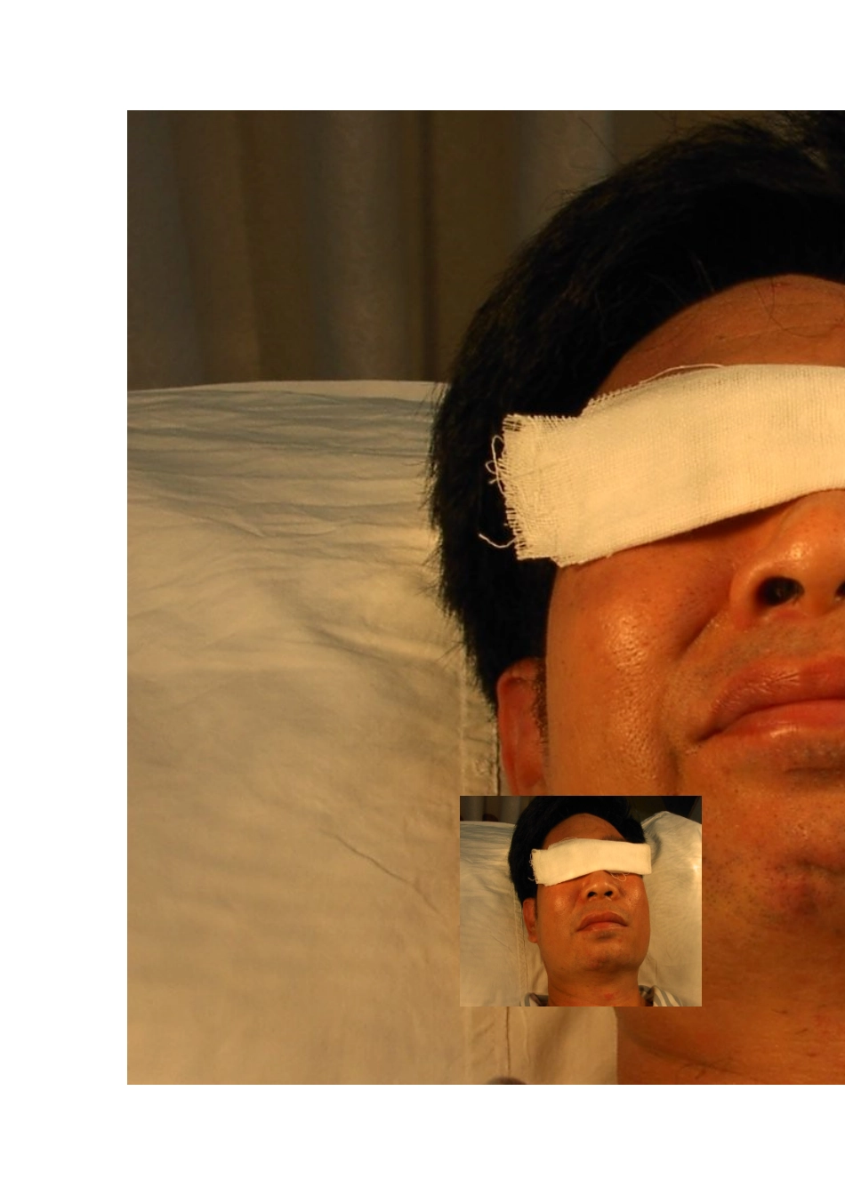 面瘫的健康宣教_第2页