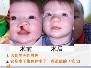 遗传病和优生优育