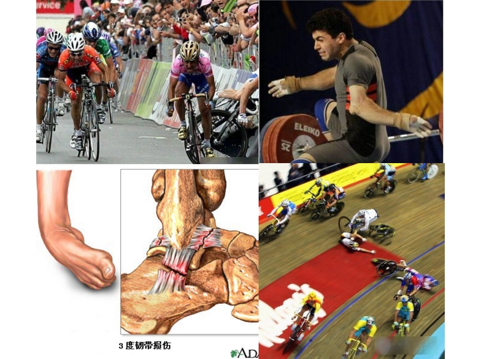 运动损伤稿22_第2页