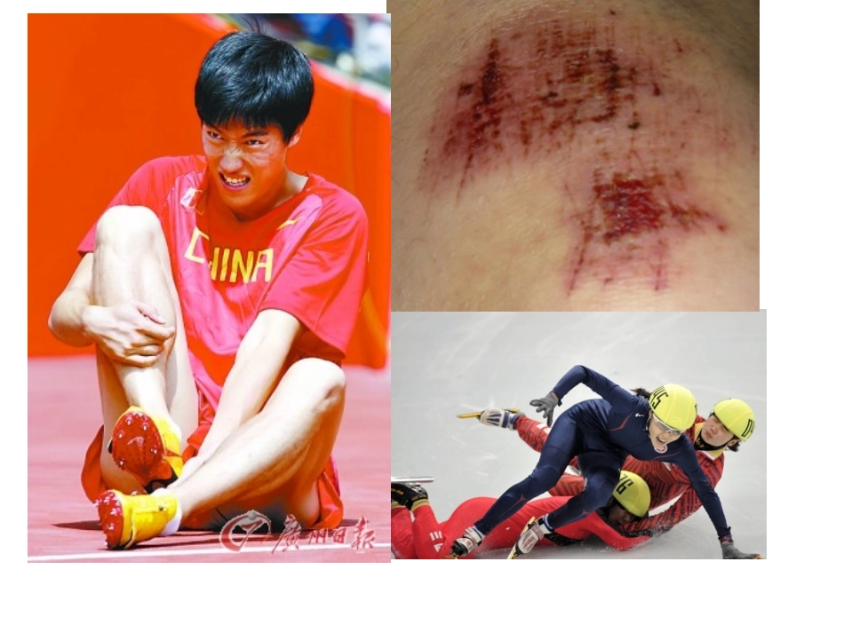 运动损伤稿22_第3页