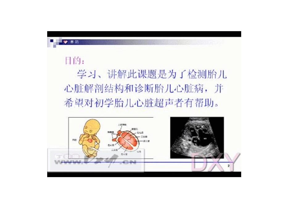胎儿心脏解剖结构的超声判定_第3页