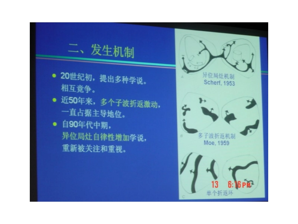 心房颤动的射频消融治疗讲稿_第3页