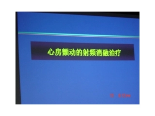 心房颤动的射频消融治疗讲稿