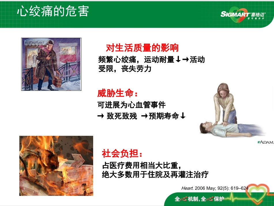 心绞痛治疗的全新选择_第2页