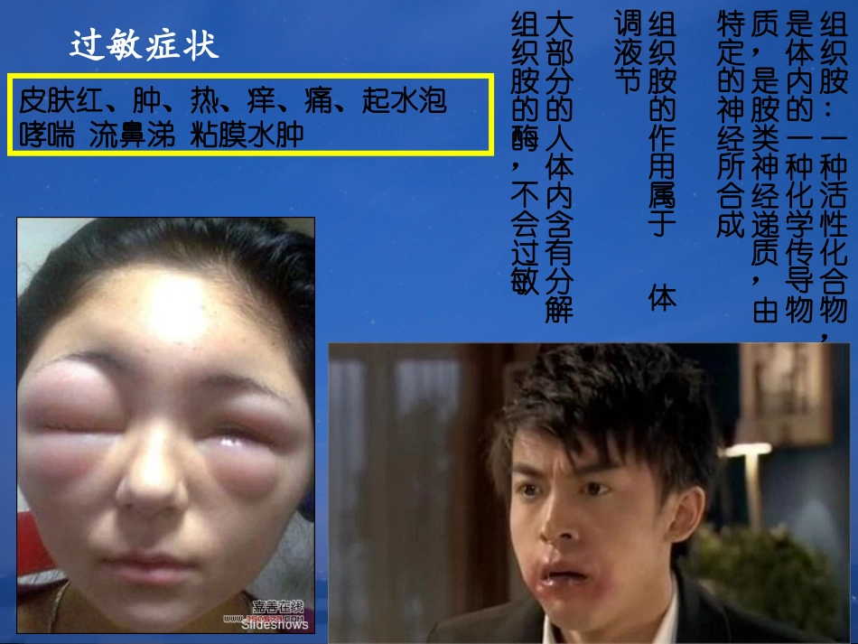 过敏——郭敏杰4_第3页