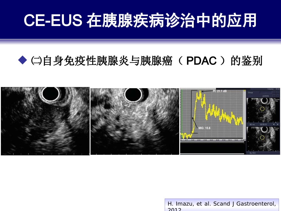 造影增强EUS与胰腺疾病诊治(2)_第2页