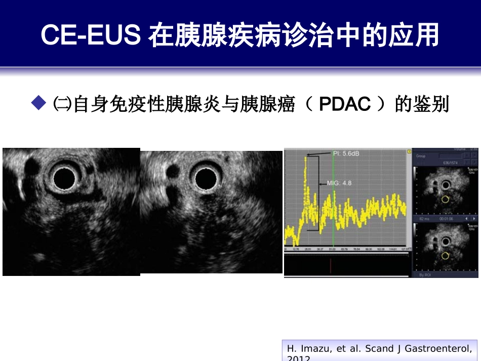 造影增强EUS与胰腺疾病诊治(2)_第3页