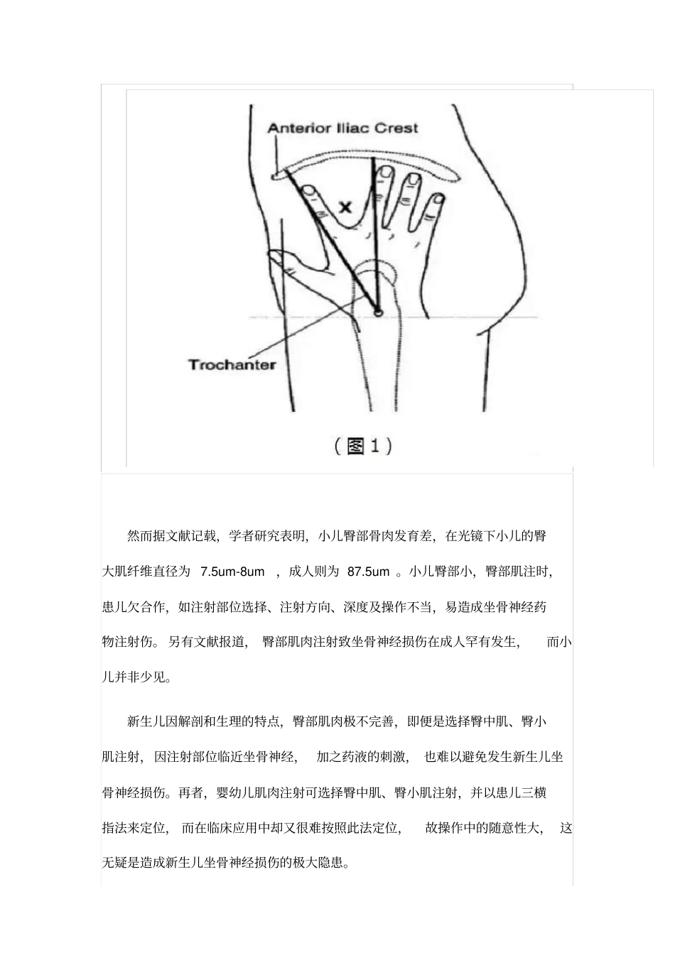 新生儿肌肉注射讲解_第2页
