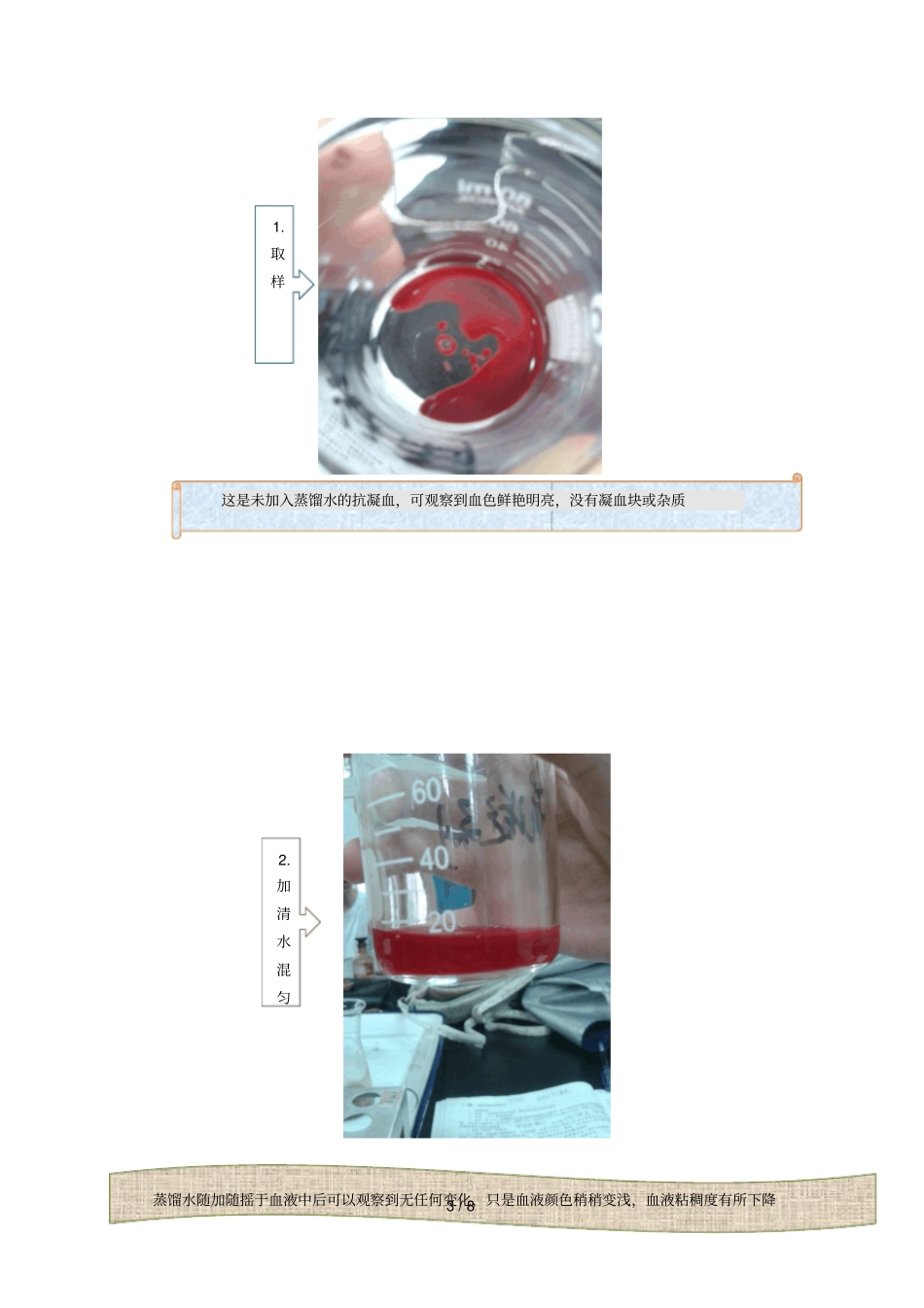 无蛋白血滤液制备_第3页