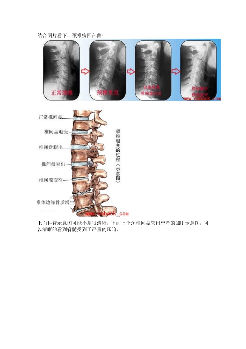 如何保护自己的颈椎_第2页