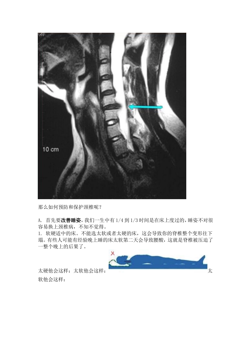 如何保护自己的颈椎_第3页