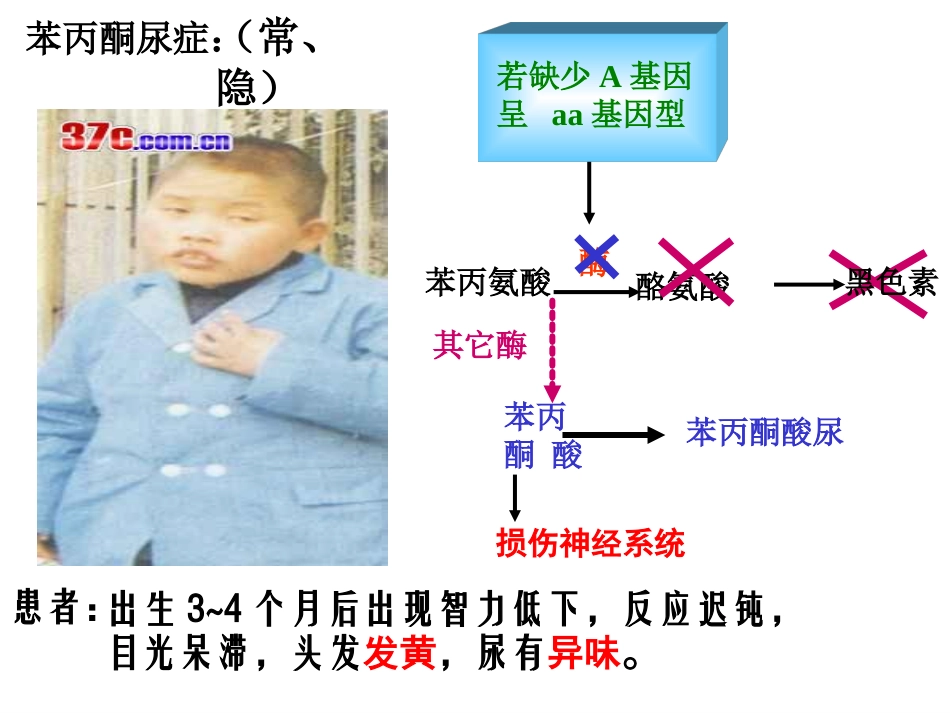 人类遗传病公开课课件_第3页
