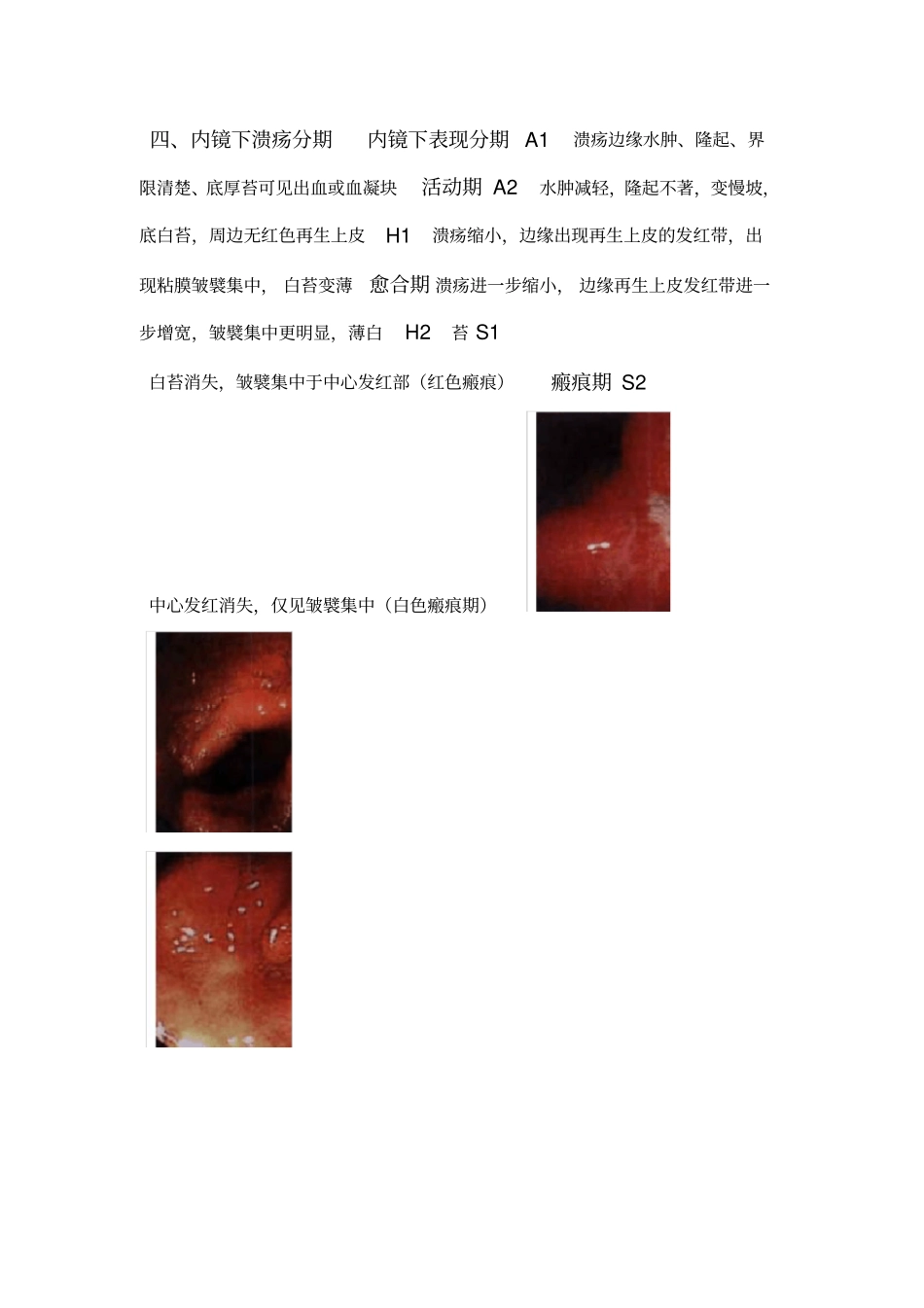 消化内镜诊断标准分级_第2页