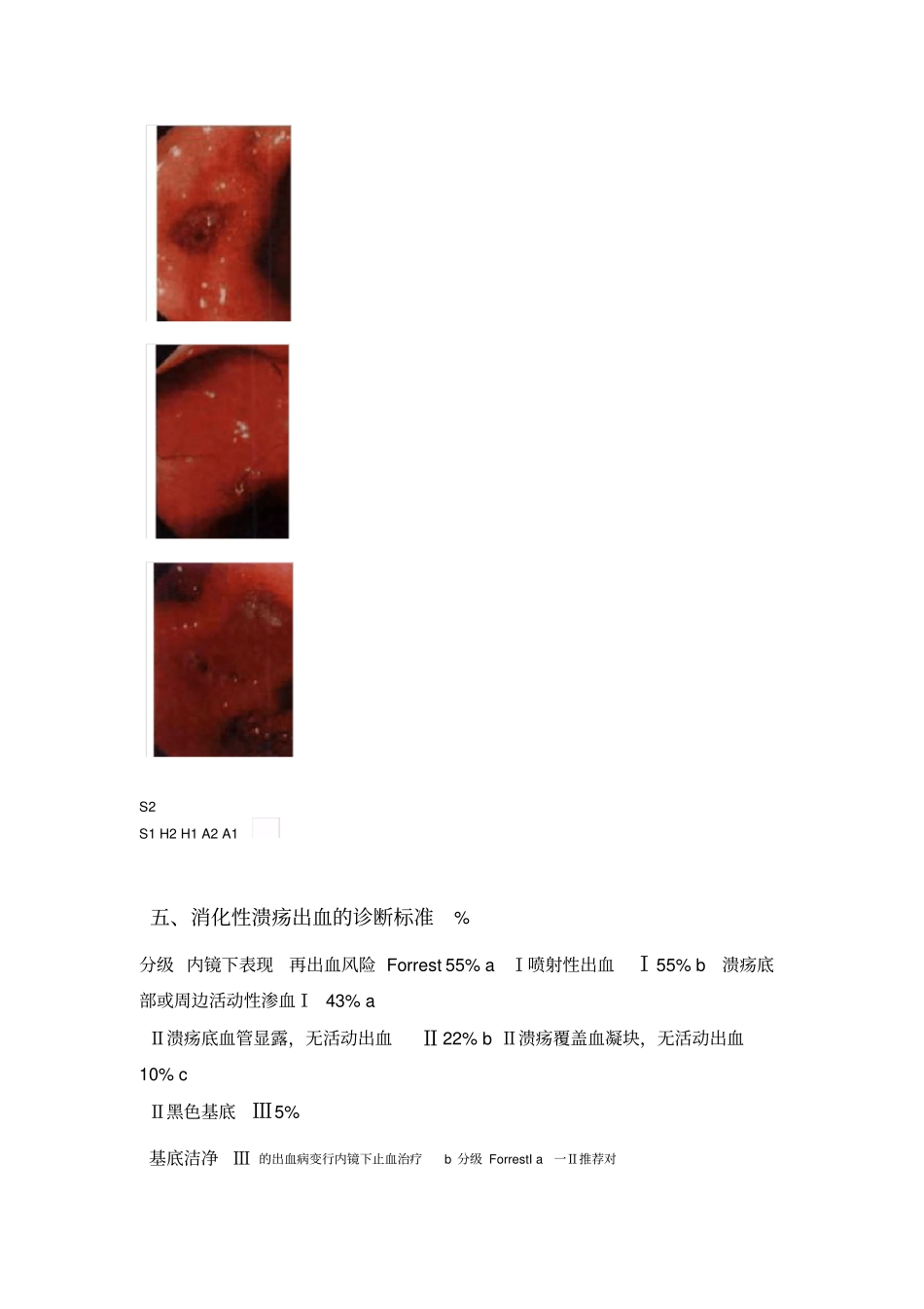 消化内镜诊断标准分级_第3页
