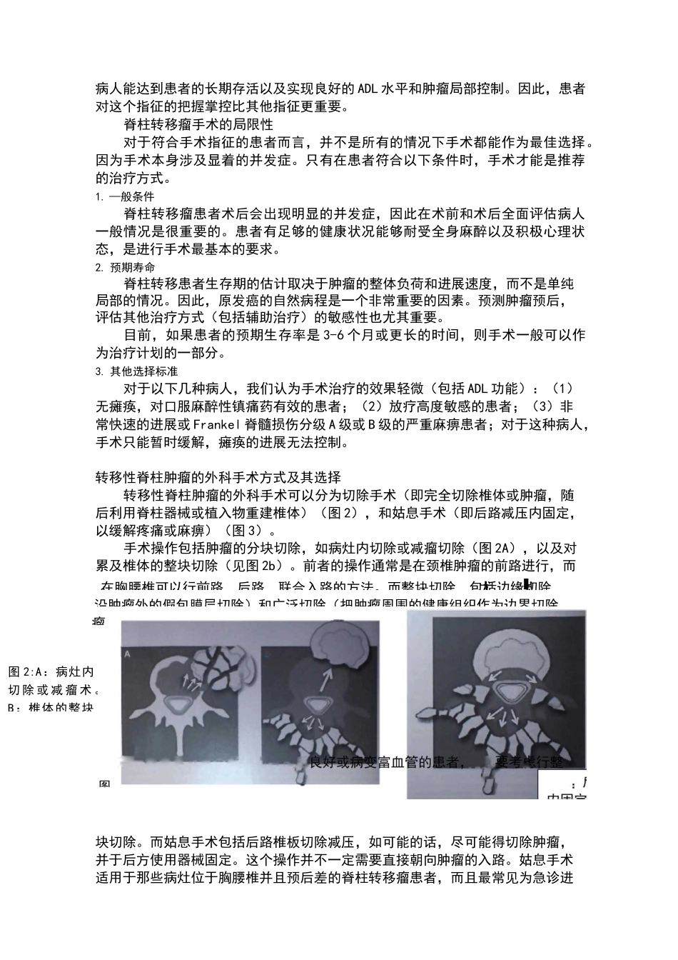 脊柱转移瘤的治疗原则_第3页