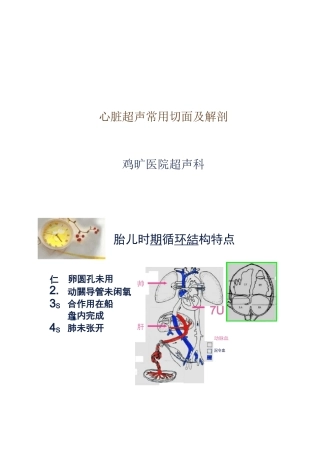 心脏超声常用切面及解剖.