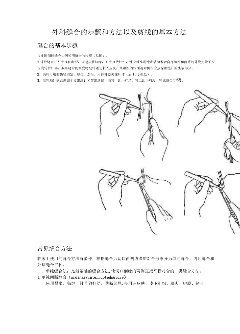 外科缝合的步骤和方法及剪线的基本方法_第1页