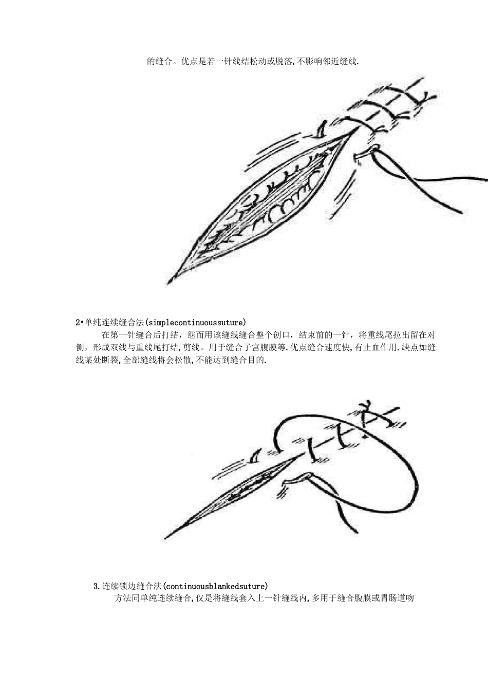 外科缝合的步骤和方法及剪线的基本方法_第2页