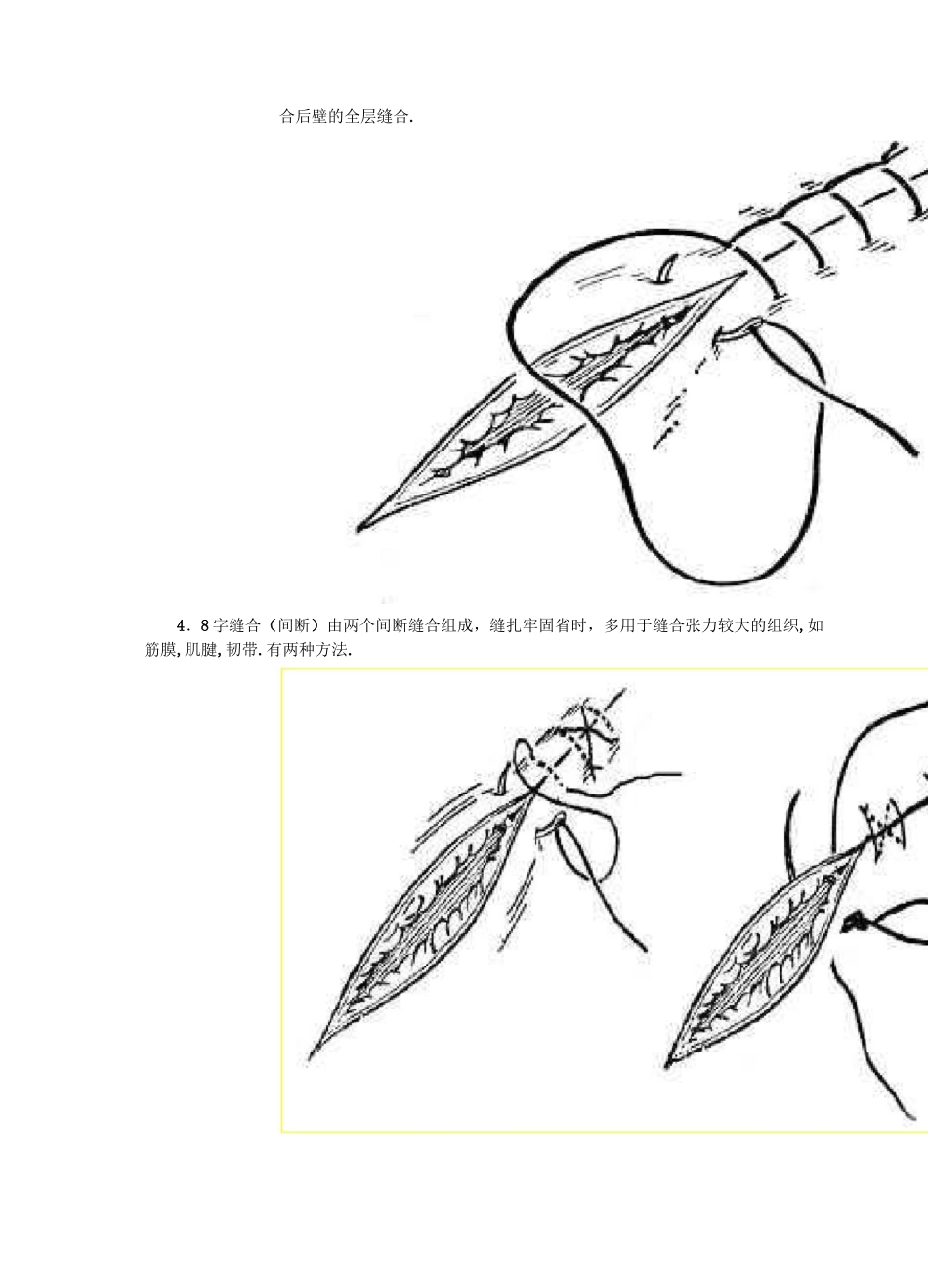 外科缝合的步骤和方法及剪线的基本方法_第3页
