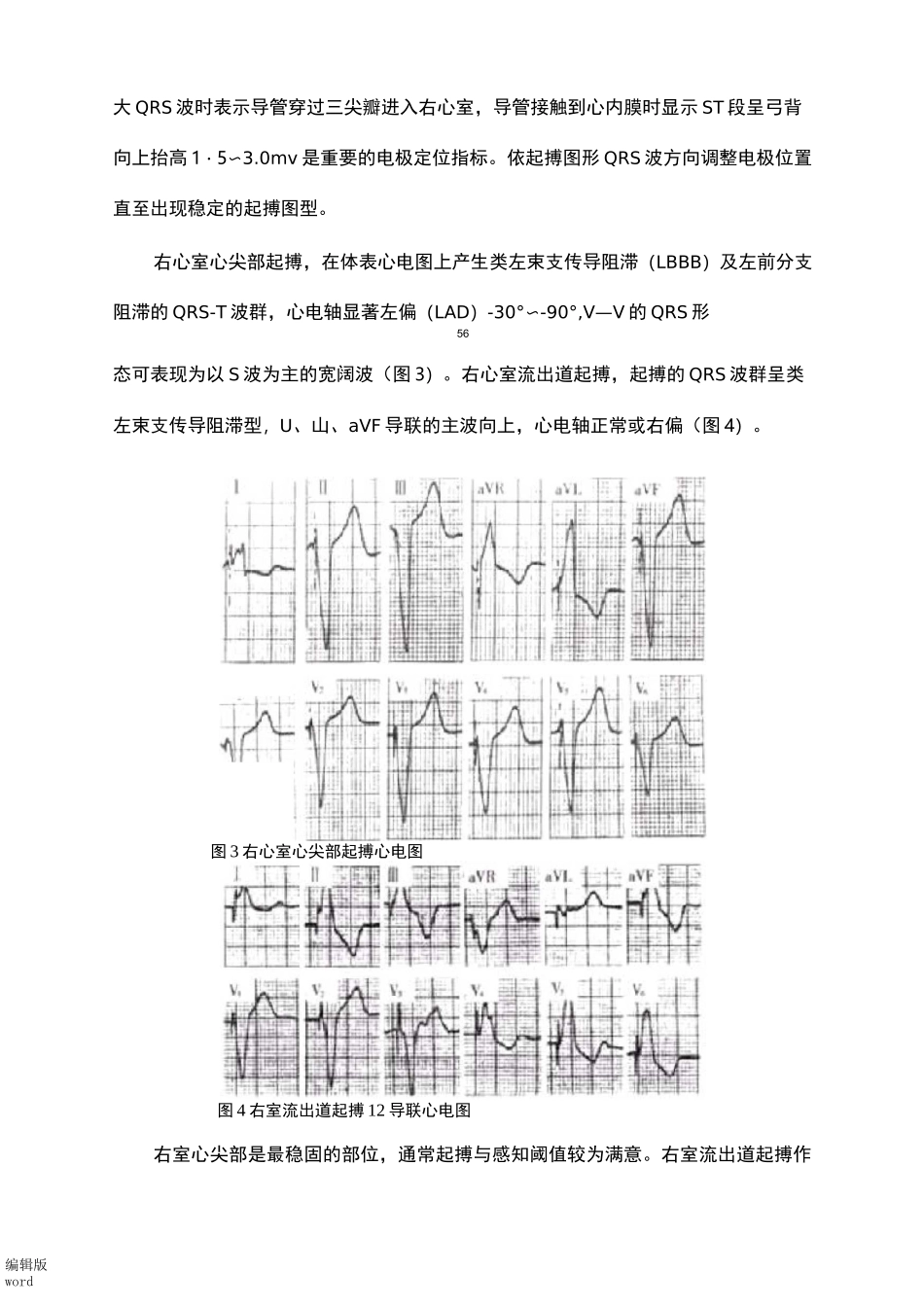 临时心脏起搏器的安置术_第2页