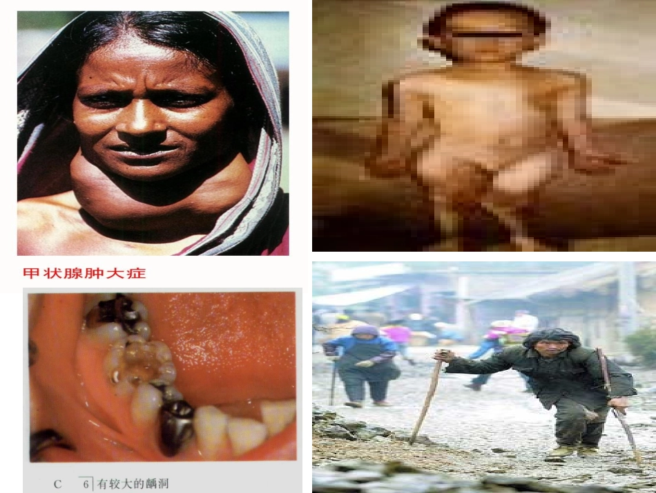 化学元素与人体健康._第2页