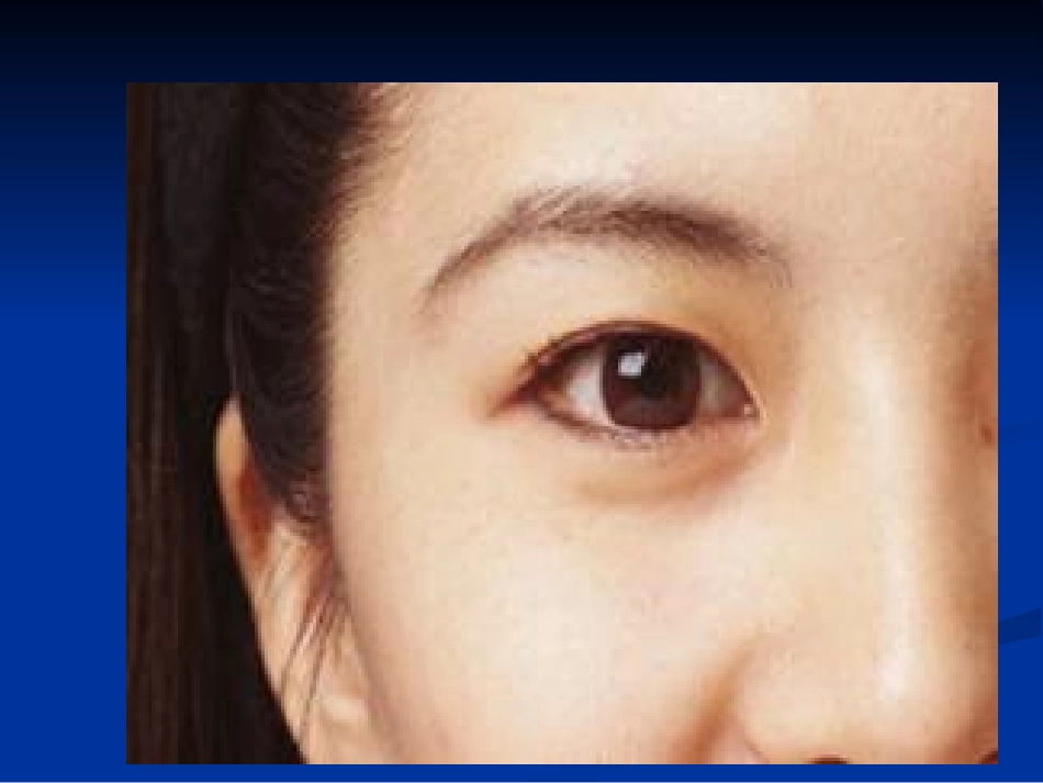 眼睛和眼镜 课件_第3页