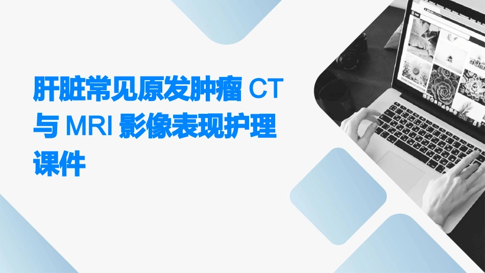 肝脏常见原发肿瘤CT与MRI影像表现护理课件_第1页