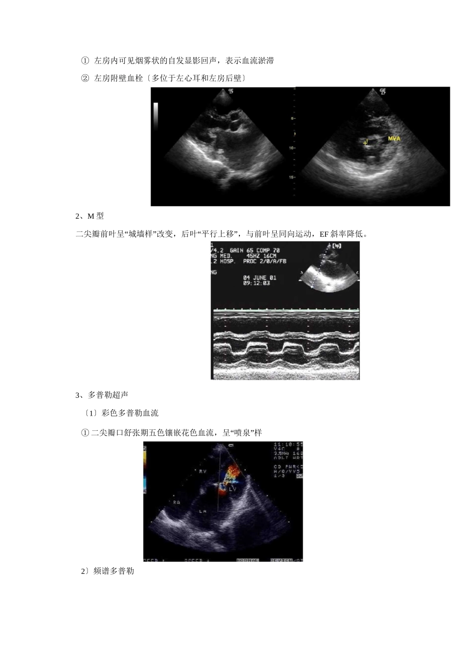心脏瓣膜病(超声)_第3页