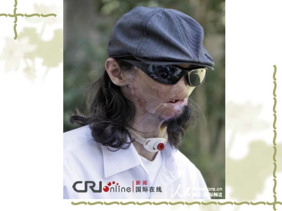 动物细胞工程2_第3页
