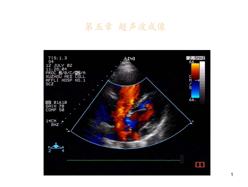 第5章-超声波成像_第1页