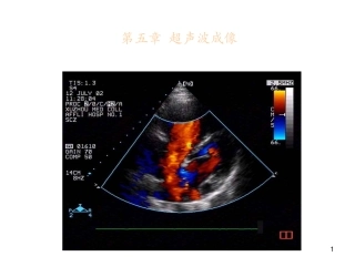 第5章-超声波成像