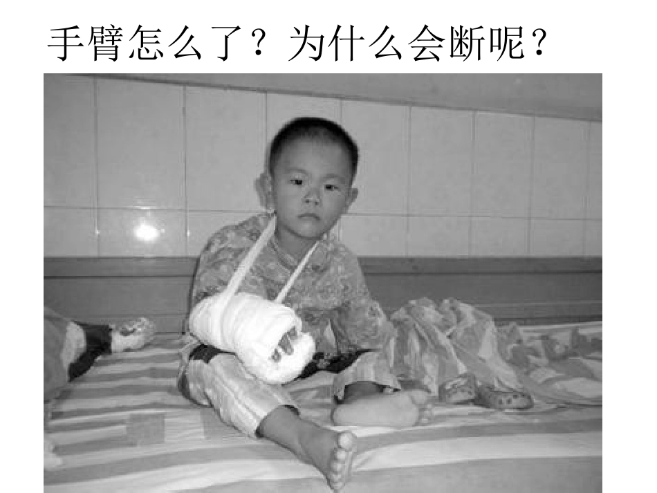 健康：人体的骨骼_第2页