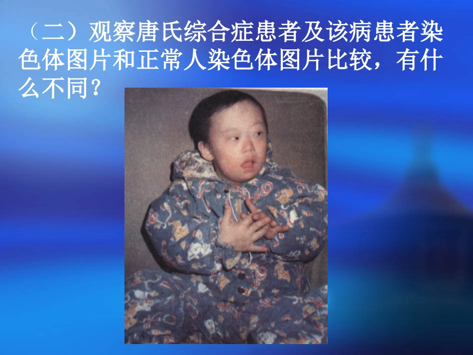 遗传病与优生_第3页