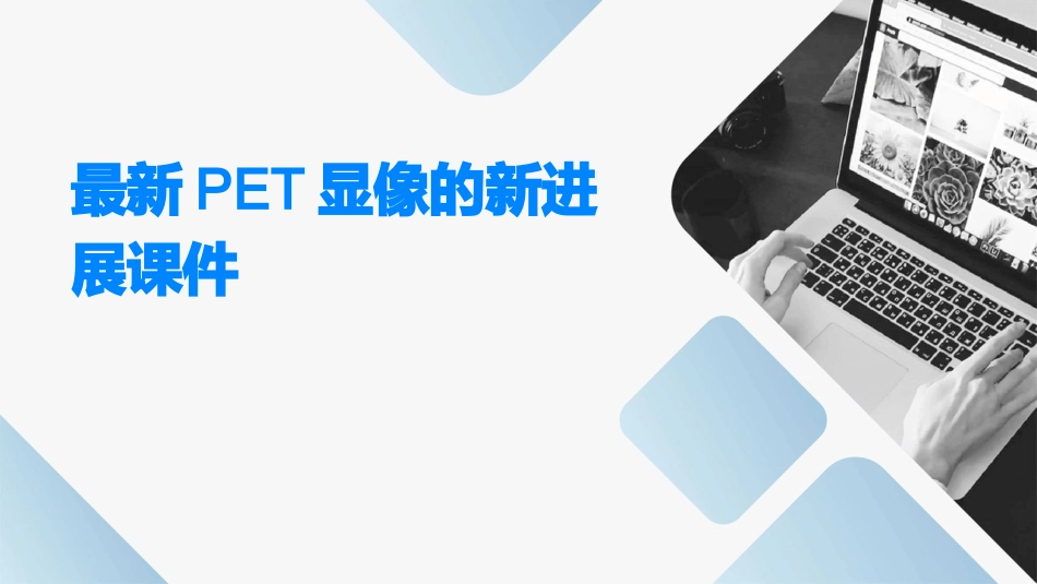 最新PET显像的新进展课件_第1页